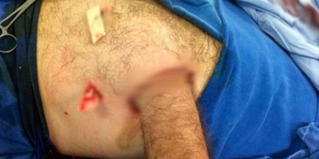 Böylesi daha önce hiç olmadı! Görenler şok oldu