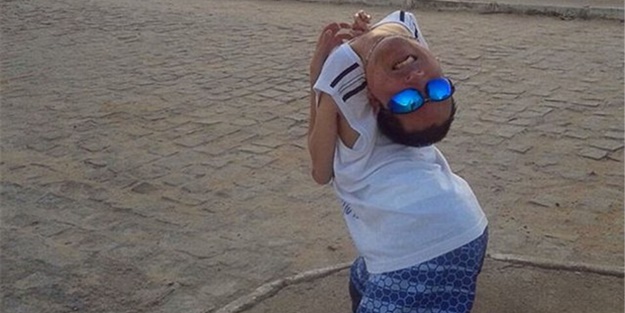 Boynu ters doğan Oliveira 40 yaşında