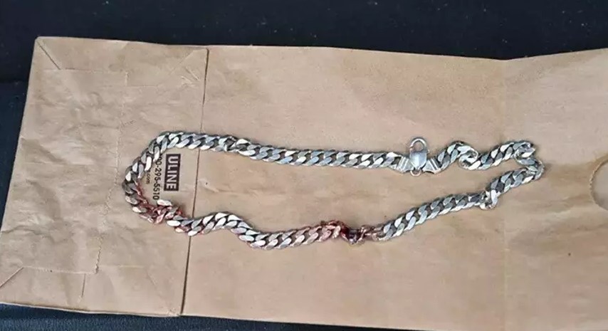 Boynundan vurulmuştu! Bakın ne sayesinde hayatta kaldı