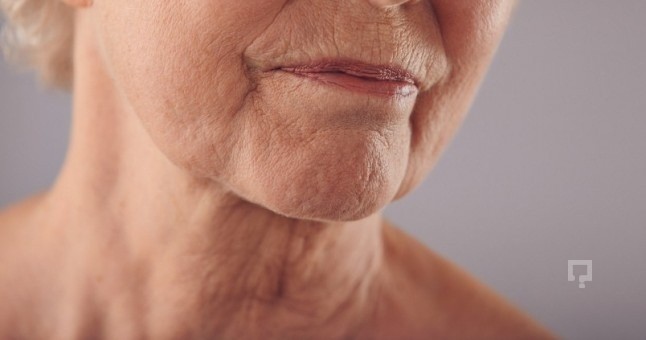 Boyun sarkmasının nedenleri