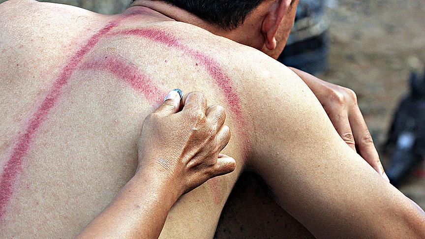 Bozuk para artık sağlık hizmetlerinde de kullanılıyor