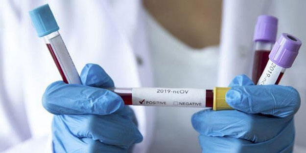 Koronavirüsten en çok onlar etkilendi... Ölü sayısı artıyor!