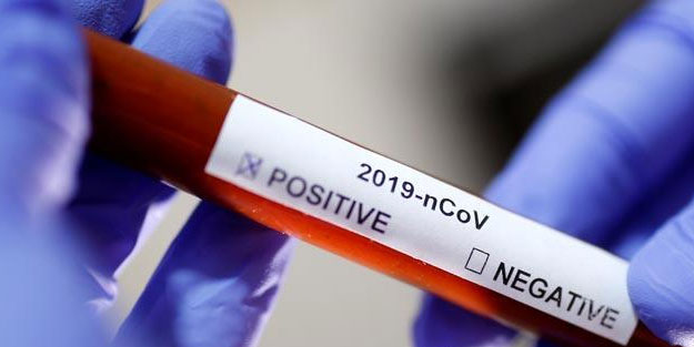 Brezilya'da corona virüsten ölenlerin sayısı arttı