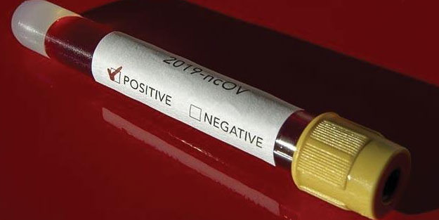 Brezilya'da koronavirüs bilançosu artıyor