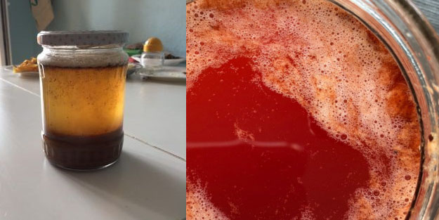 Bronşit balgam ve döş hırıltısına bire bir! Doğal tarifi mutlaka deneyin