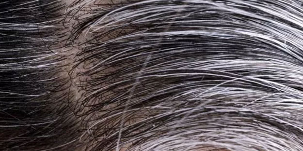 Bu 3 besini az tüketmek beyaz saçlara davetiye çıkarıyor