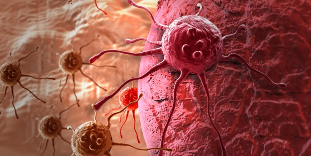 Bu 6 etken sizi kanser yapabilir! - FOTO