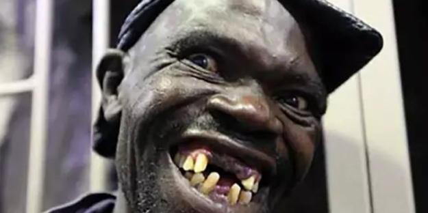 Bu adamın sonu herkesi şaşırttı! Akıllara durgunluk veren olay: 4 kez dünyanın en çirkin insanı…