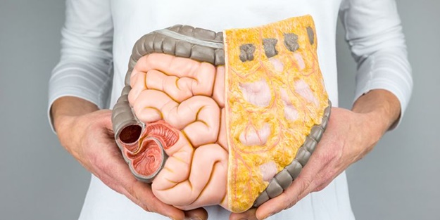 Bu alışkanlıklardan uzak durun! Yoksa bağırsağınızı kaybedebilirsiniz...