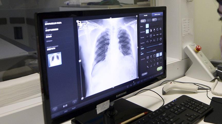 Bu ameliyat Türkiye'de ilk kez yapıldı