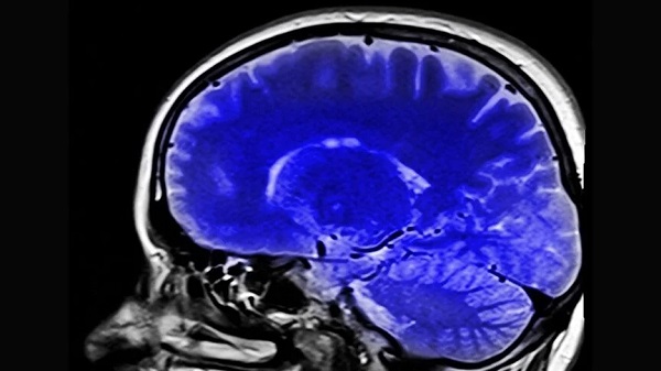 Bu araştırma umut olacak! Kronik ağrı çekenlere müjde