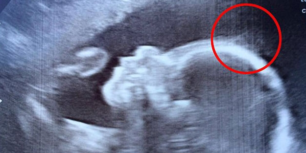 Bu bebeği görenler gözlerine inanamıyor!