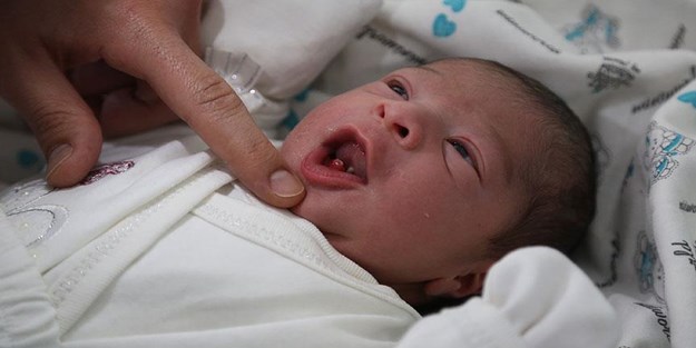 Bu bebek iki dişli doğdu!