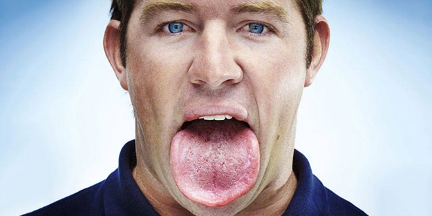 Bu belirtiler dil kanserinin habercisi!