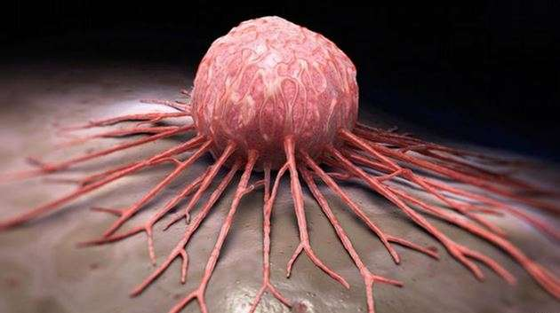 Bu belirtiler varsa aman dikkat! Kanserin habercisi olabilir