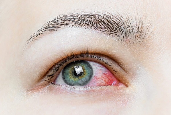 Bu belirtilere dikkat edin! Tedavi edilmezse sonuç ciddi olabilir