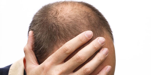 Bu besin kelliğe son veriyor