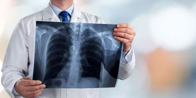 Bu besinler Akciğerleri temizliyor