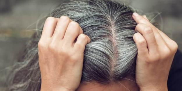 Bu besinleri tüketenler saç dökülmesinden kurtuluyor: Boya masrafına son! Mısır'daki hint yağı bitkisi...