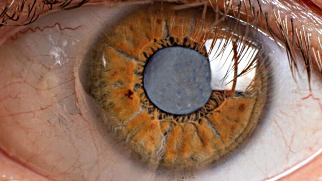 Bu bitki ile görüşünüz kat ve kat artacak! Doğal kullanılan tarif: Hemen bunu yapalım