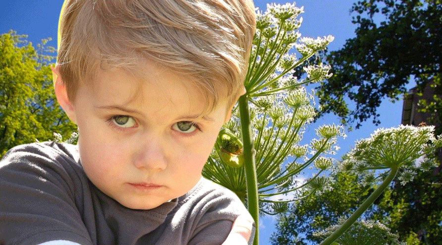 Bu bitki Türkiye’de de var! Dokunan yanıyor… Son kurbanı 4 yaşında çocuk oldu