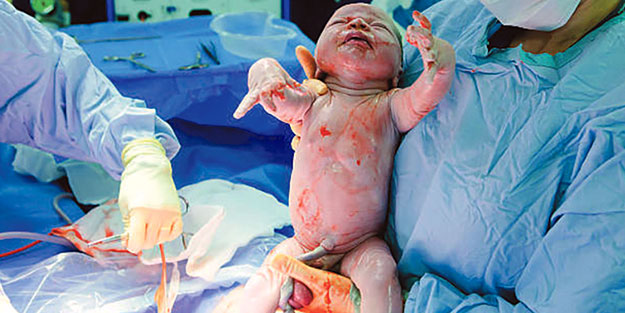 Bu çağrıya kulak verin: Bebeğinize kıymayın anneler..! Sezaryen'de otizm riski