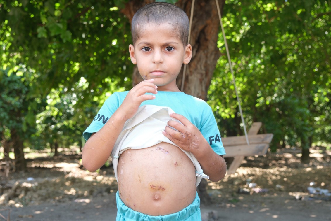 Bu çocuğa iyi bakın! Başıboş köpekler bu hale getirdi