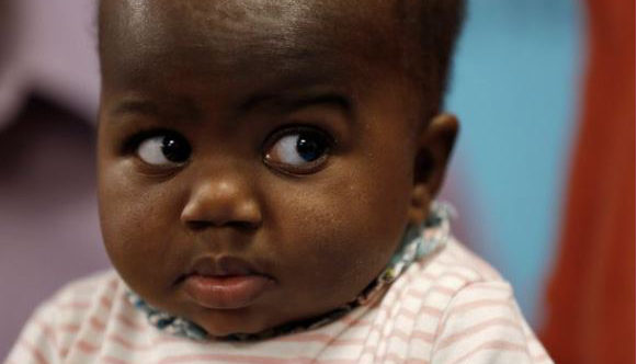 Bu çocuğun dört ayağı iki omurgası var!