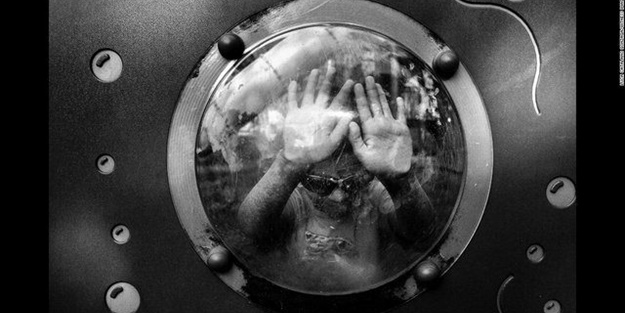 Bu çocuk gölgede yaşamak zorunda!