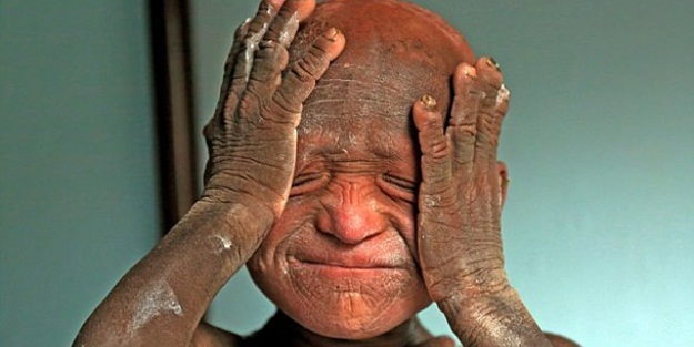 Bu çocuk gün geçtikçe taşlaşıyor