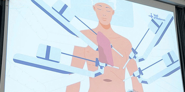 Bu da oldu! Akciğer naklini robotlar gerçekleştirdi