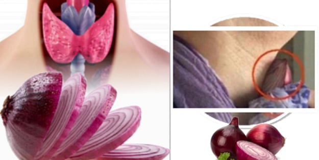 Bu faydasına inanamayacaksınız! Boynunuza soğan bağlayıp bir süre beklerseniz...