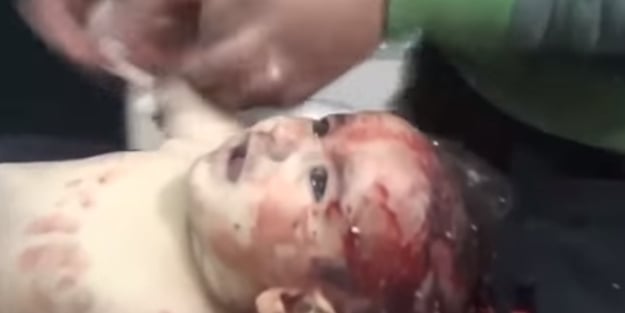 Suriyeli bebekler canlı canlı gömülüyor (video)