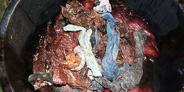 Bu görüntüler insanları utandırmalı! Midesinden 40 kilogram plastik çıktı