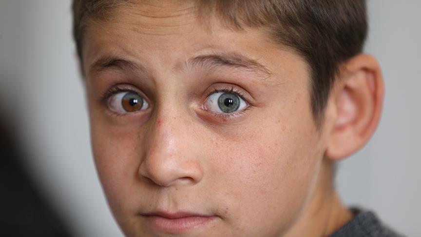 Bu gözleri görenler şaşırıyor!