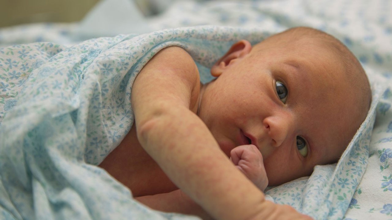 Bu hastalık sessiz ilerliyor! Çocuğunuz sık sık terliyorsa dikkat