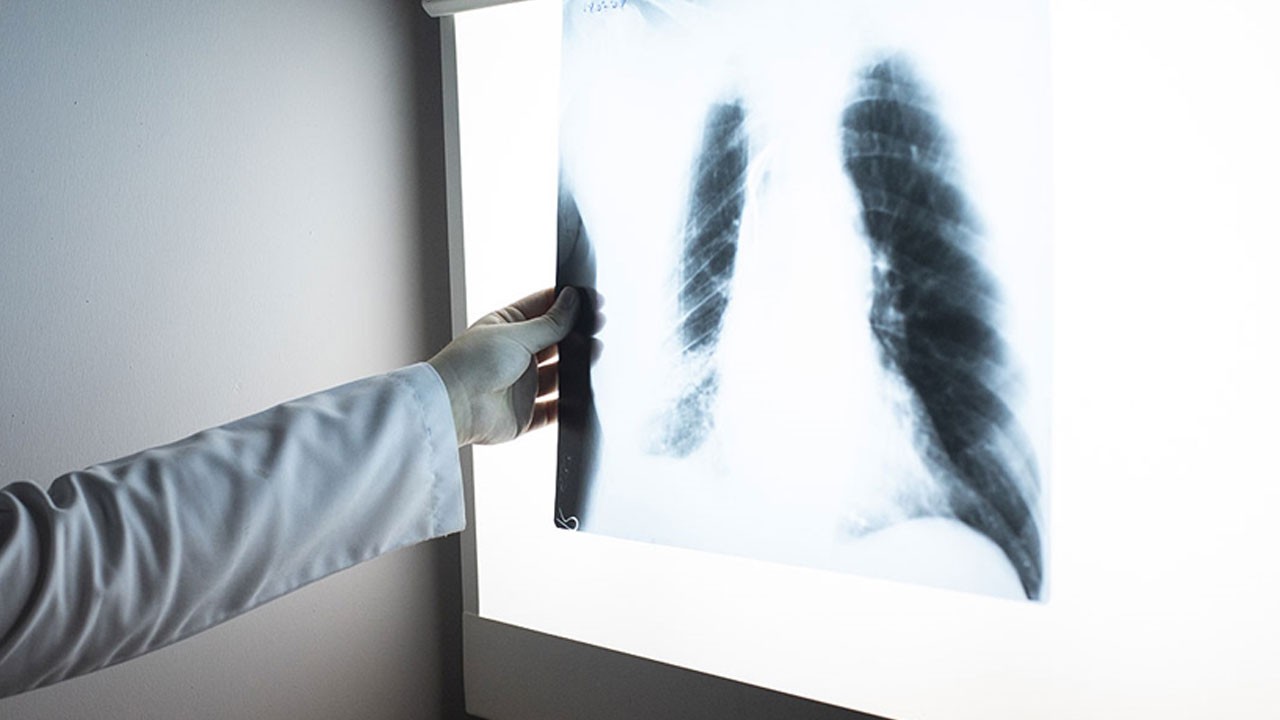 Bu hastalıkta ölüm oranı yüksek! Antibiyotiklere rağmen risk sürüyor