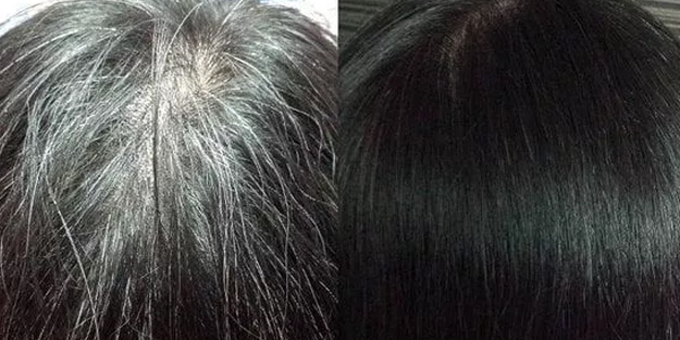 Bu içecek ile beyaz saça elveda deyin: Böylesi ne görüldü ne duyuldu! Beyaz saçlar kabus olmaktan çıkıyor