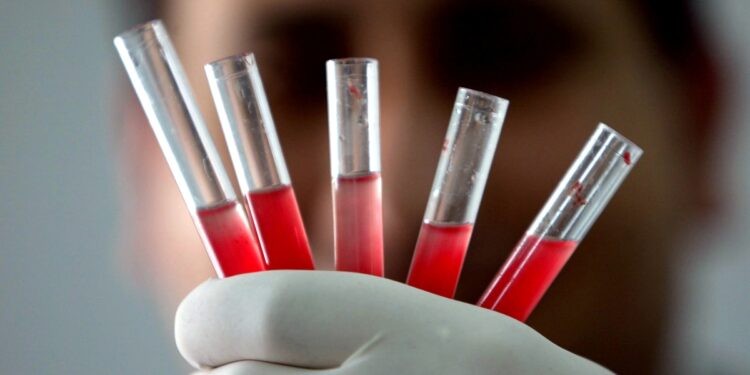 Bu kan grubuna sahip kişilerin hafızası çok zayıf! Dün ne yediklerini bile hatırlamıyorlarmış