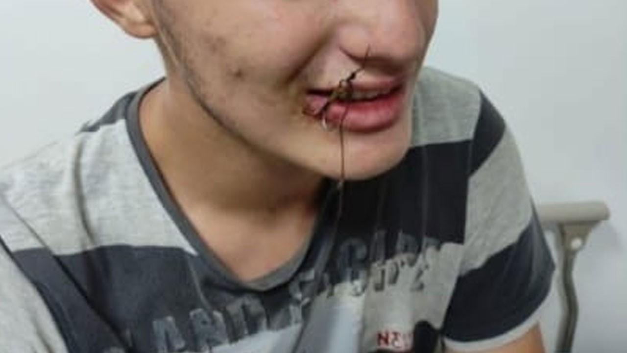 Bu kez oltaya balık değil çocuk takıldı