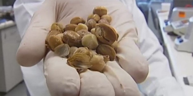 Bu meyve kanserin kökünü kazıyor!