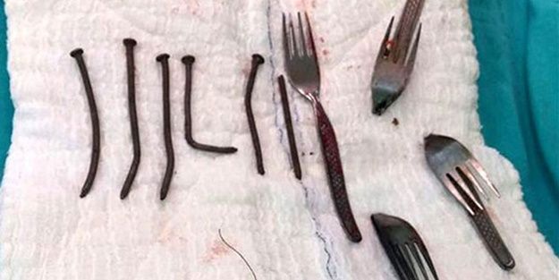 Resimdekilerin hepsi midesinden çıktı!