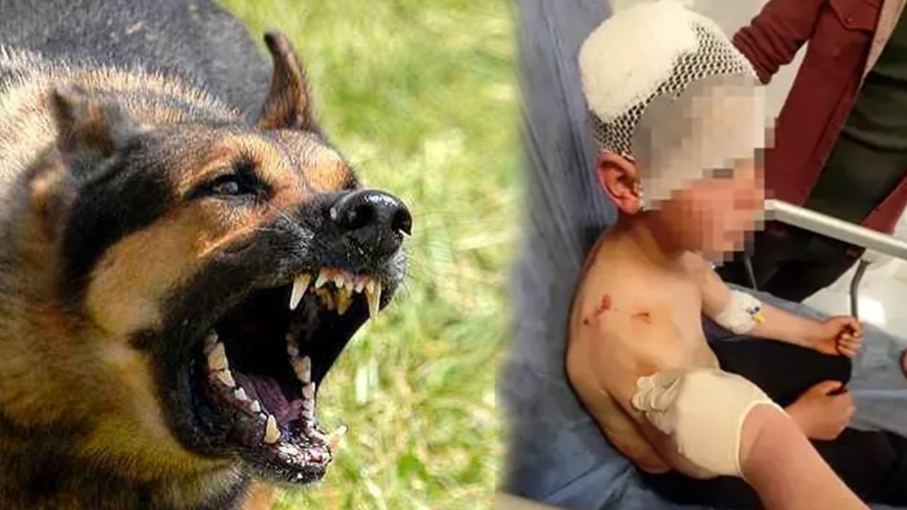 Bu saldırının hesabını kim verecek?... Yine köpek saldırısı, yine çocuk yaralı...