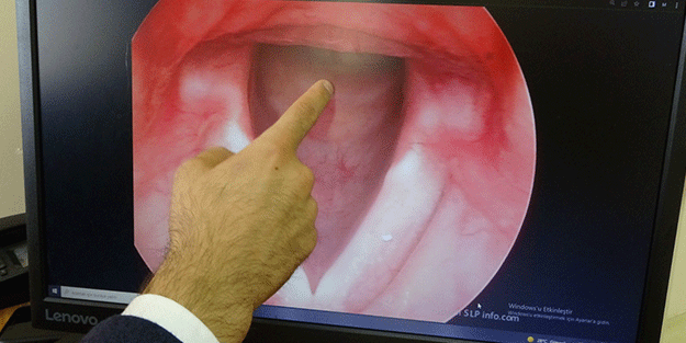 Bu sorun sizde de olabilir Sesiniz giderek kısılıyorsa dikkat!