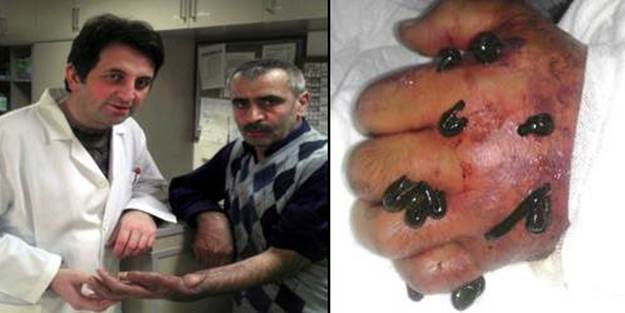 Mucize tedavi bileğini kurtardı!