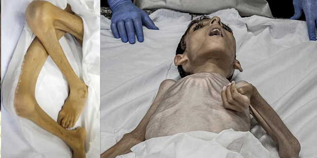 Bu utanç daha ne kadar sürecek? Gazze'de bir çocuk daha açlıktan öldü!