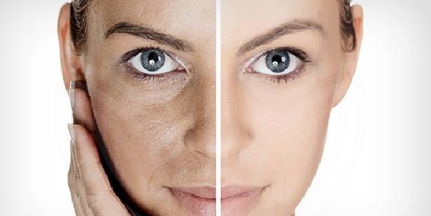Bu yöntem ameliyata gerek kalmadan cildi gençleştiriyor