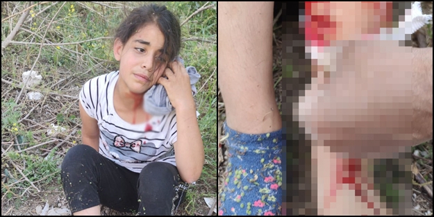 Bu zulmü durdurun: Başıboş köpekler, küçük kızı kanlar içinde bıraktı!
