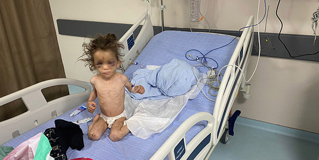 Buna yürek dayanmaz! Annesi günlerce aç bıraktığı 5 yaşındaki çocuğuna işkence etti