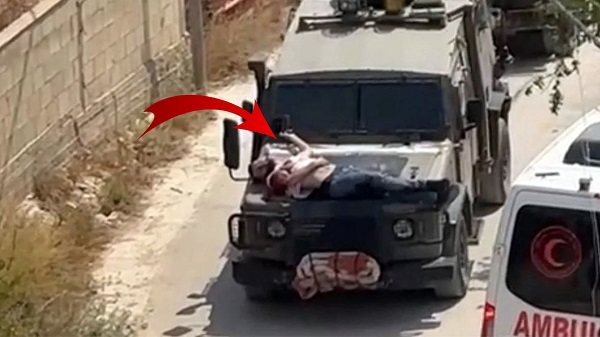 Bunlar hayvan bile olamaz! İşgalci katillerden yaralıya alçak muamele